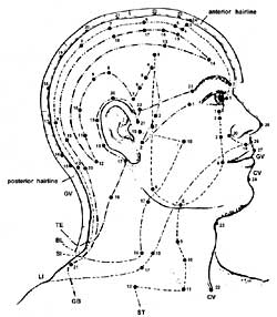 Chinese acupuncture diagrams