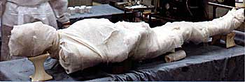 A present-day mummy